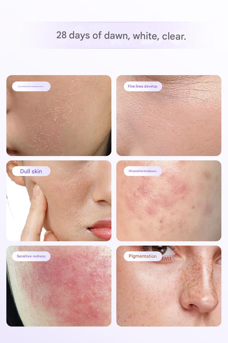 Red Light Therapy Facial Device - 8